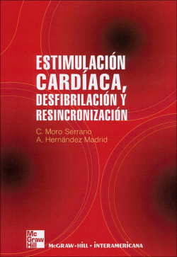 Estimulacion cardiaca y resincronizacion