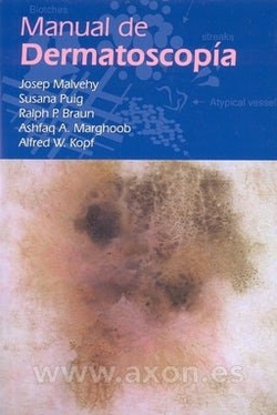 Manual de dermatoscopia
