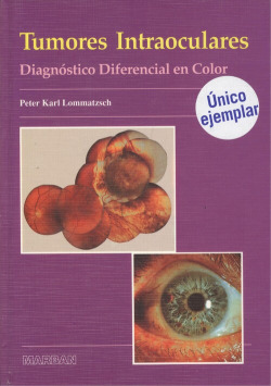 TUMORES INTRAOCULARES DIAGNOSTICO DIFERENCIAL EN COLOR