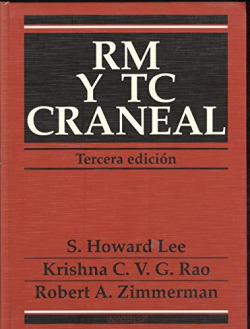 RM Y TC DE COLUMNA
