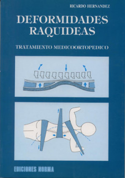 DEFORMIDADES RAQUIDEAS