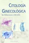 Citologia ginecologica de papnicolaou a bethesca