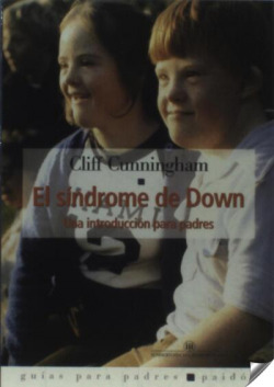 EL SINDROME DE DOWN