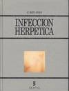 INFECCION HERPETICA