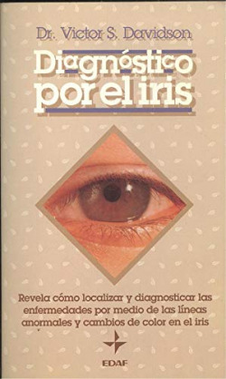 DIAGNOSTICO POR EL IRIS