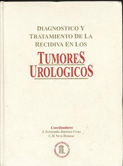 DIAGNOSTICO Y TRATAMIENTO DE LA MEDICINA EN LOS TUMORES UROL