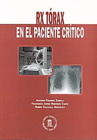 Rx tórax en el paciente crítico