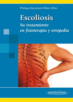 Escoliosis: su tratamiento en fisioterapia y ortopedia