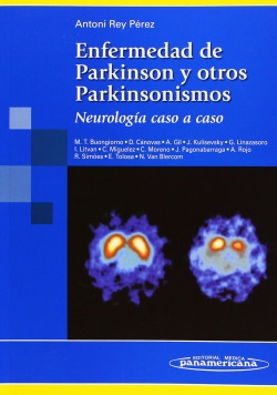 ENFERMEDAD DE PARKINSON Y OTROS PARKINSONISMOS