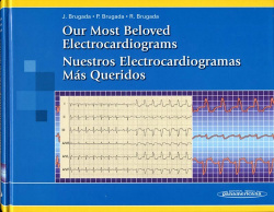 Our Most Beloved Electrocardiograms. Nuestros Electrocardiogramas Más Queridos (Edición bilingüe)