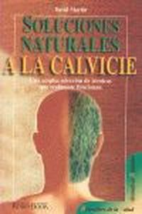 SOLUCIONES NATURALES A LA CALVICIE