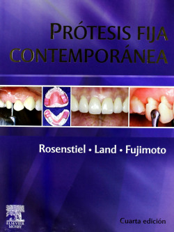 Prótesis fija contemporánea