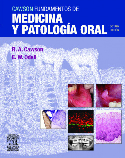 Cawson. Fundamentos de medicina y patología oral