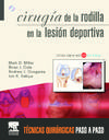 Cirugía de la rodilla en la lesión deportiva + DVD-ROM y Website