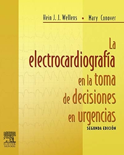 La electrocardiografía en la toma de decisiones en urgencias