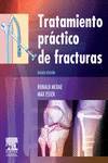 Tratamiento práctico de fracturas