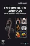 Enfermedades aórticas + DVD-ROM