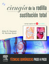 Cirugía la rodilla. Sustitución total + DVD y Web