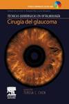 Cirugía del glaucoma + DVD-ROM