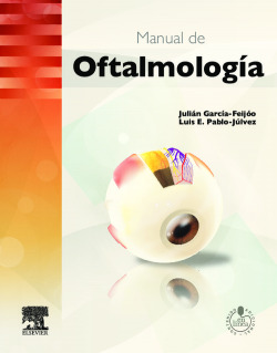 Manual de oftalmología + StudentConsult en español