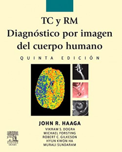 TC y RM. Diagnóstico por imagen del cuerpo humano