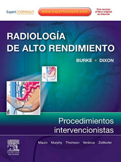 Radiología de alto rendimiento