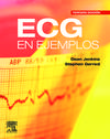 ECG en ejemplos