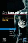 Radiología clínica: 100 diagnósticos principales en mama