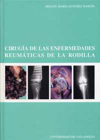 Cirugía De Las Enfermedades Reumáticas De La Rodilla