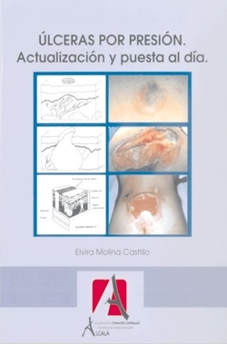 ULCERAS POR PRESION. ACTUALIZACIONES Y PUESTA AL