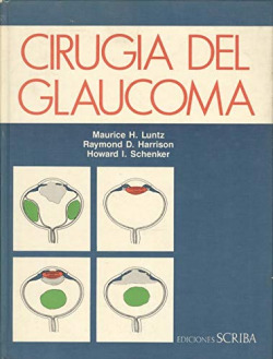 CIRUGIA DEL GLAUCOMA.