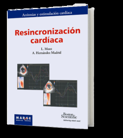 Resincronizacion cardiaca