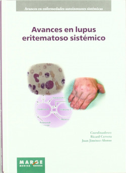 Avances en lupus eritematoso sistémico