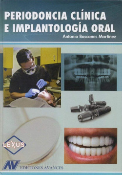 PERIODONCIA CLINICA E IMPLANTOLOGIA ORAL