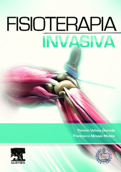 Fisioterapia invasiva + acceso web