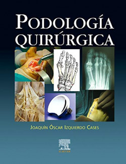 Podología quirúrgica