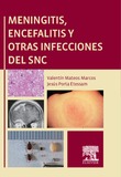 Meningitis, encefalitis y otras infecciones del SNC
