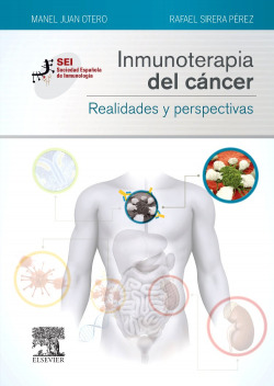 Inmunoterapia del cáncer. Realidades y perspectivas
