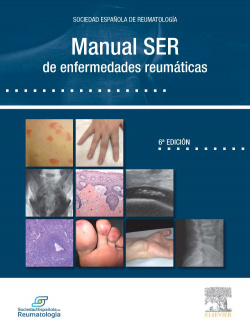 Manual SER de enfermedades reumáticas