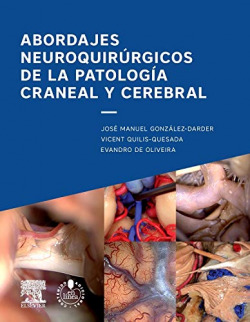 ABORDAJE NEUROQUIRURGICO DE LA PATOLOGIA CRANEAL Y CEREBRAL