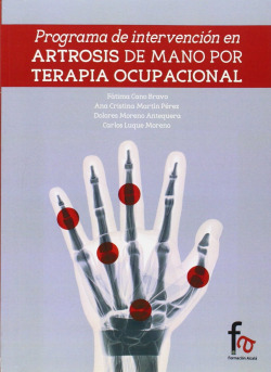 PROGRAMA DE INTERVENCIÓN EN ARTROSIS DE MANOS POR TERAPIA OC