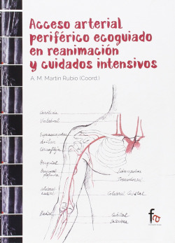 ACCESO ARTERIAL PERIFÉRICO ECOGUIADO EN REANIMACIÓN Y CUIDAD