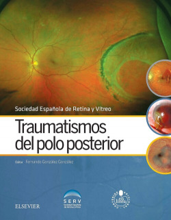 Traumatismos del polo posterior + acceso web