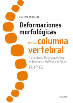Deformaciones morfológicas de la columna vertebral
