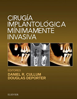 CIRUGÍA IMPLANTOLÓGICA MINIMAMENTE INVASIVA