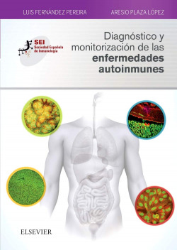 DIAGNÓSTICO Y MONITORIZACIÓN DE ENFERMEDADES AUTOINMUNES