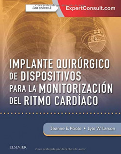 IMPLANTE QUIRÚRGICO DE DISPOSITIVOS PARA LA MOTORIZACIÓN DEL RITMOS CARDÍACO +EXPERTCONSULT