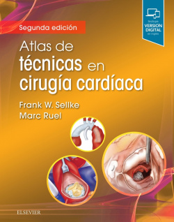 ATLAS DE TÈCNICAS EN CIRUGÍA CARDIACA