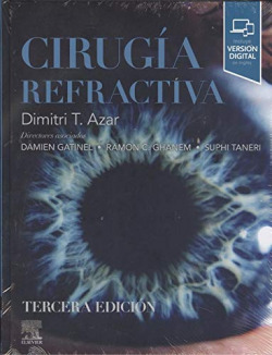 CIRUGÍA REFRACTIVA