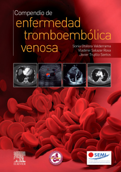 Compendio de enfermedad tromboembólica venosa